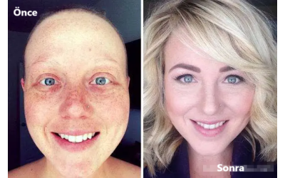 ÇAĞIMIZIN HASTALIĞI KANSER